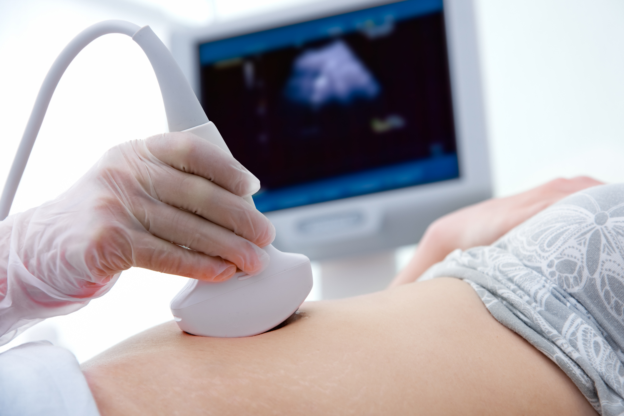 Ultrassom na gravidez: quantos a grávida tem que fazer?